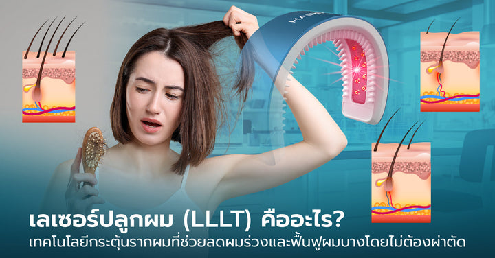 เลเซอร์ปลูกผม (LLLT) คืออะไร? ทางเลือกในการรักษาผมร่วงและหัวล้านจากพันธุกรรมที่ไม่ต้องผ่าตัด