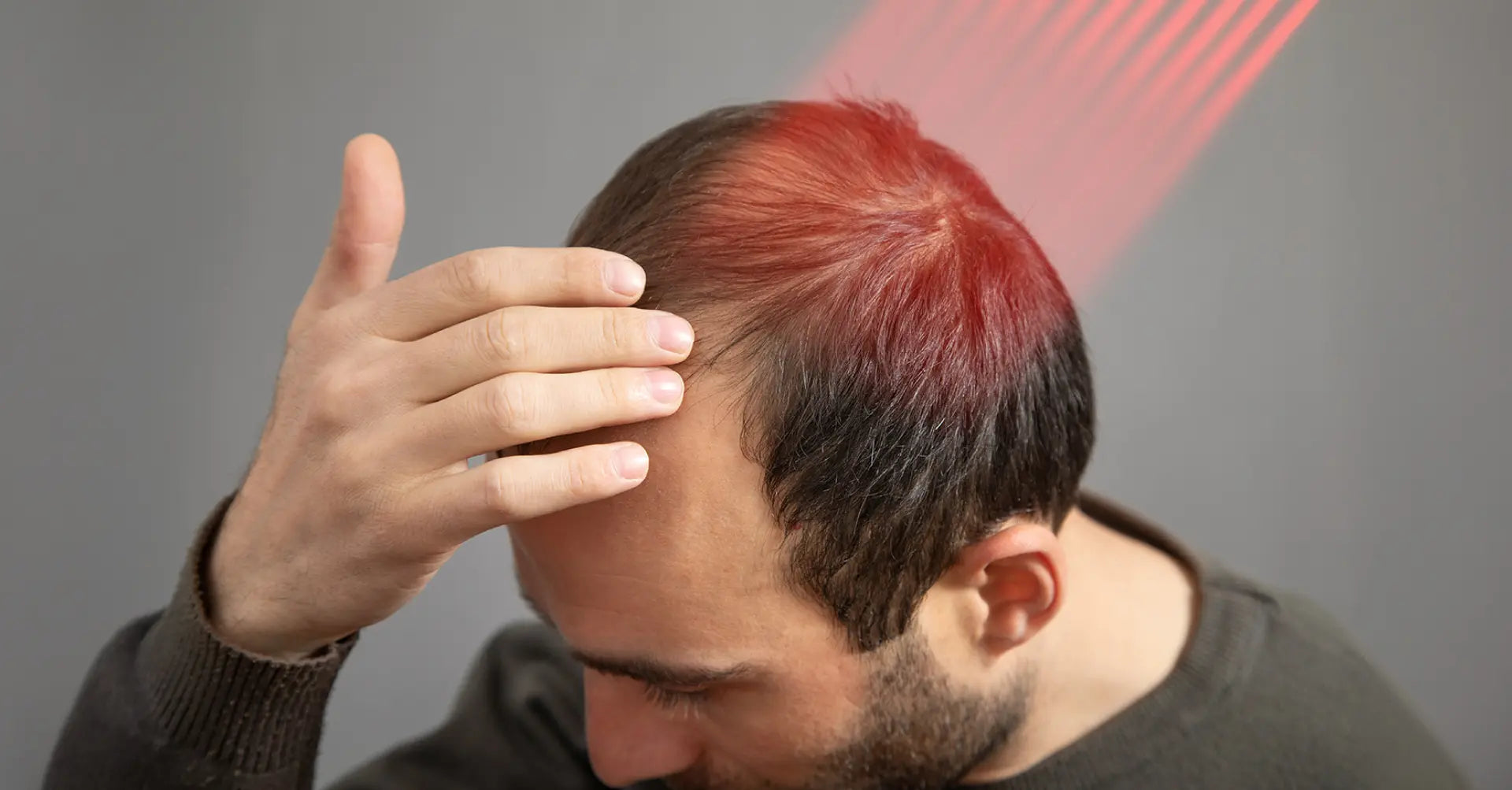 การใช้แสงเลเซอร์พลังงานต่ำเพื่อกระตุ้นการงอกของเส้นผม (Avci et al., 2014)