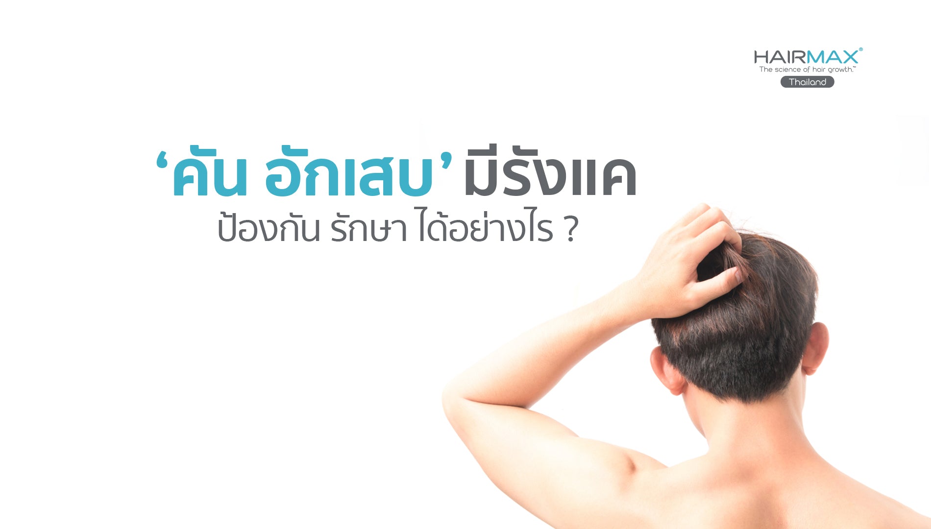 ‘คัน อักเสบ’ มีรังแค ป้องกันรักษาได้อย่างไร ?