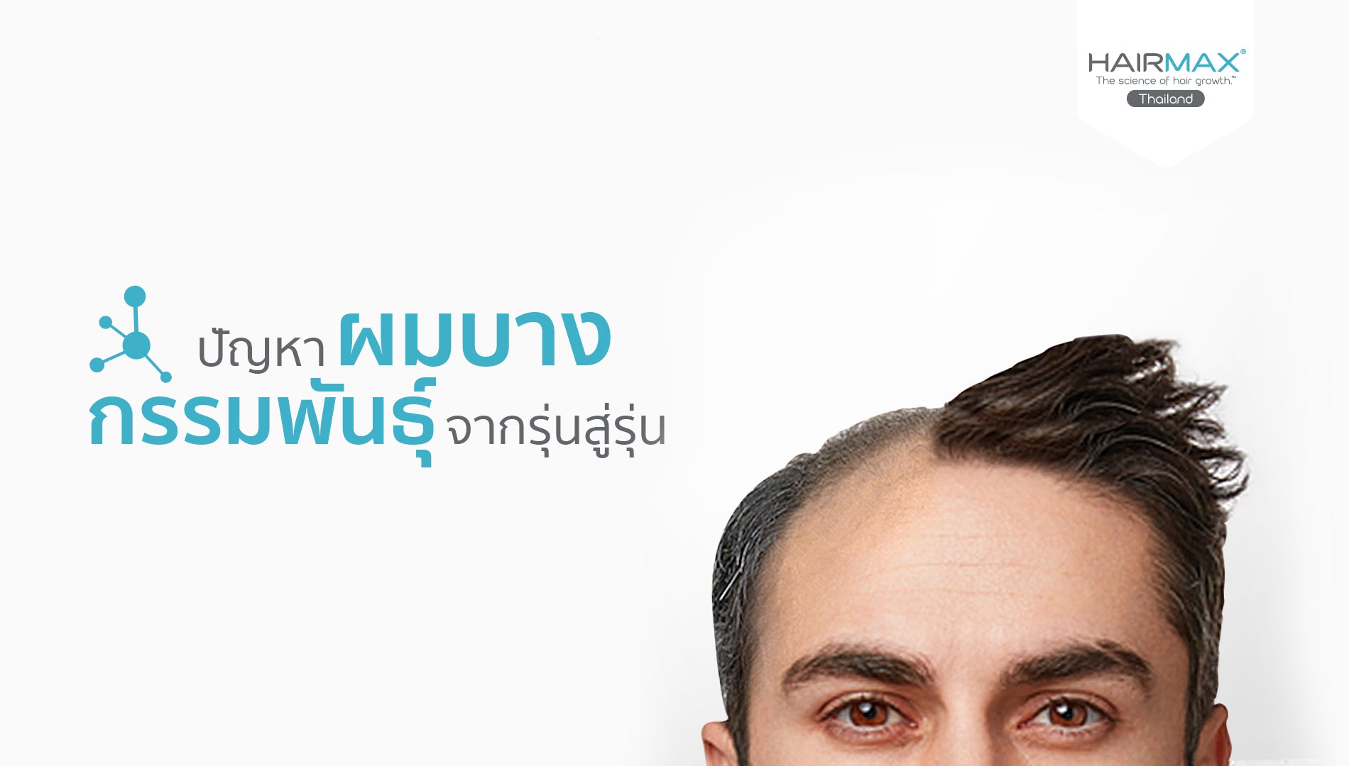 ปัญหาผมบาง กรรมพันธุ์ จากรุ่นสู่รุ่น !