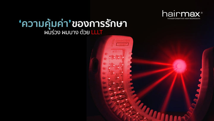 เลเซอร์ รักษาผมร่วงได้อย่างไร?
